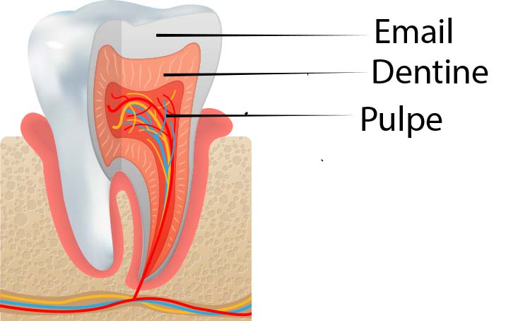 Blanchiment des dents prix maroc